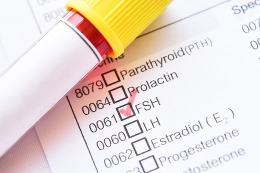 FSH : valeurs normales, femme, homme, ménopause ?