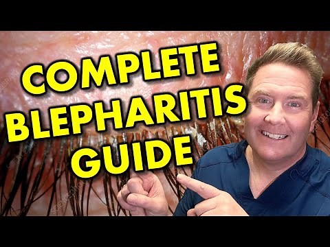 Everything about Blepharitis Types, Symptoms & Treatment