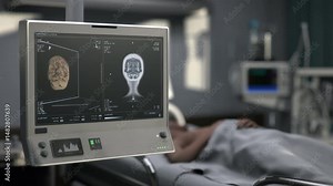 Hospital imaging device analysing the insides of a skull to identify disease. Imaging the damaged brain in the skull to diagnose a disease. Imaging the skull of the patient suffering from a disease.