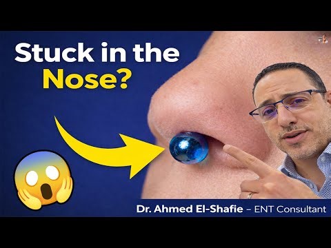 Foreign Object in a Child’s Nose: Warning Signs Parents Should Never Ignore