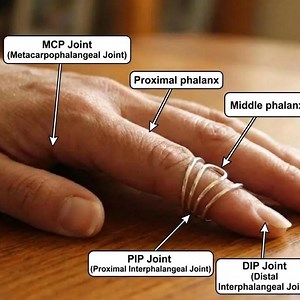 Silver Arthritis Splint Ring, Lateral Deviation Support, EDS Ring, Mallet Finger Splint, Boutonniere Deformity Brace, Trigger Finger Splint - Etsy
