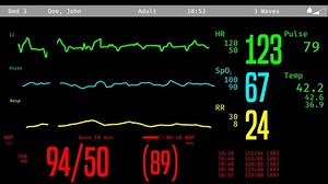Icu Screen Monitoring Dying Patient Vital Stock Footage Video (100% Royalty-free) 20286238 | Shutterstock