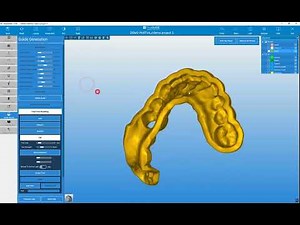 RealGUIDE Software: Surgical Guide Modeling- Part 1