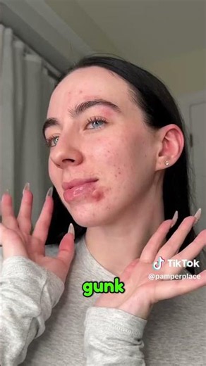 Mighty Patch Hero Cosmetics Review | Best Hydrocolloid Acne Pimple Patch for Overnight Zit Removal