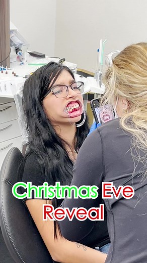 Y’all ain’t ready! #dentistry #viraldentist #smileagain #cosmeticdentistry #smilemakeover #fyp #christmasreveal