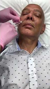 Versa Injectable Filler Treatment for Wrinkles | Genesis Medical Spa