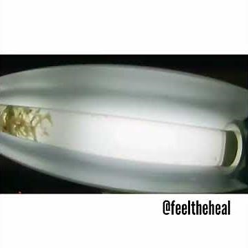 Live video - See an intestinal parasite during a colonic Irrigation - Feel The Heal Miami