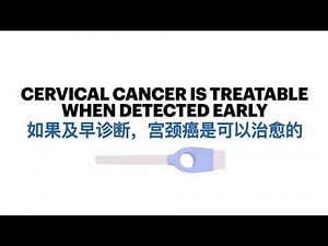 Cervical Cancer Screening: How to use Delphi Screener
