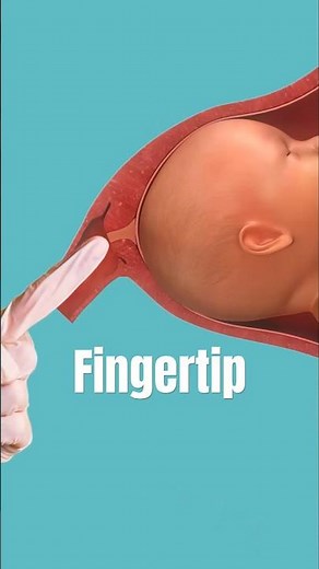 Membrane Sweep Procedure #pregnancy