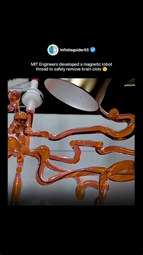 Unlimited Science 🇮🇱 on Instagram: "🧠✨ MIT engineers just changed brain surgery FOREVER! They’ve developed a magnetic robot thread that can safely travel through blood vessels to remove deadly brain clots — no open surgery needed! 🤯 Imagine a future where doctors guide these tiny bots through your brain with magnets… this is not sci-fi anymore, it’s real innovation happening right now! 🚀 💡 The future of medicine is here — and it’s microscopic. . 👉 Follow : @infiniteguider03 👉 Follow : @i