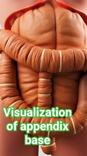 Clear visualization of base #health #leproscopy #appendix #surgical view #viral #abdomenanatomy #