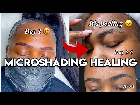 MICROSHADING HEALING DAY BY DAY PROCESS
