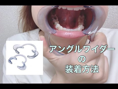 【オンライン診療①】アングルワイダーの使い方