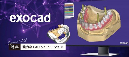 歯科用CADソフトウェアexocad特集 | デンケン・ハイデンタル株式会社