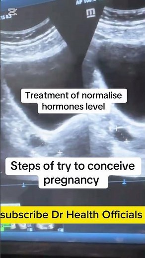 steps of Trying to conceive pregnancy Dr Health Officials