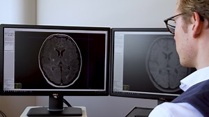 Convolutional autoencoder-based deep learning for intracerebral hemorrhage classification using brain CT images - Watch Related Videos