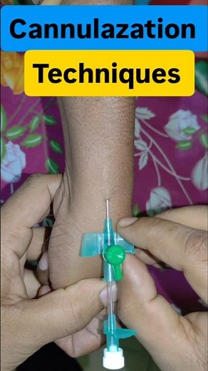IV Cannulation Technique Step by Step | Peripheral Venous Cannulation | Nursing Skills #shorts