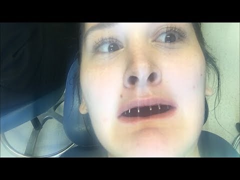 TAKING OUT MY TEETH | Bethany Wilhelm