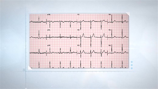 🎯 FCPS Mid-Term (Medicine) 🩺 OSCE Practice Batch – Jan'26 (OSPE, IOE & Clinical – A Complete Hands-on Preparation) --------- 📘 Why This Batch? FCPS Mid-Term লিখিত পরীক্ষার পাশাপাশি সবচেয়ে ভয় আর গুরুত্বপূর্ণ অংশ হলো OSPE & OSCE! ✅ Written গুছানো থাকলেও অনেকেই OSPE/Clinical Part এ খারাপ করেন! (লাস্ট জুলাই ২৫ সেশনে তা সর্বোচ্চ সংখ্যা!) ✅ তাই এবার আপনার প্রিপারেশন গুছিয়ে শুরু করুন ডিসিএ’র Special OSCE Practice Batch এর সাথে। --------- 🌟 Real Exam এর মতো প্রস্তুতি – এক জায়গায় সব কিছু! (OSPE, IOE 
