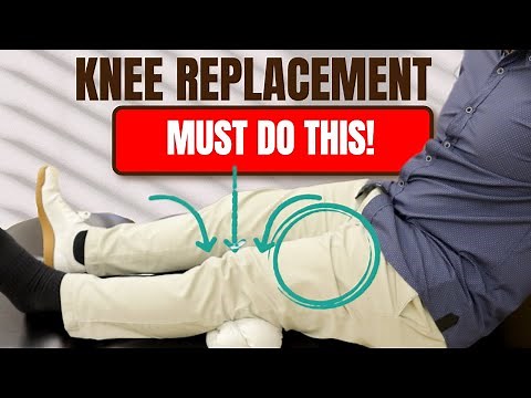 Top 5 Must-Do Exercises for a Faster Recovery After Knee Replacement Surgery