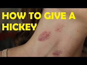learn how to give someone a hickey fast