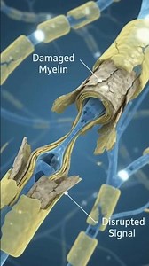 Peripheral Neuropathy Explained 🧠🧬 | How Nerve Damage Affects the Body | 3D Medical Animation