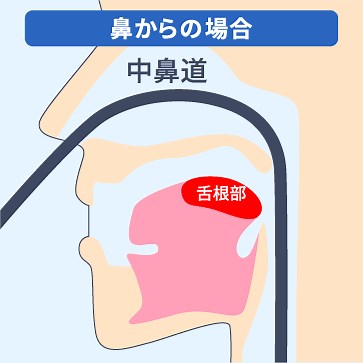 胃カメラ検査