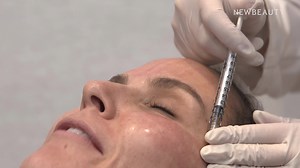 26K views · 48 reactions | The vampire facial (microneeding with PRP)  is one of the trendiest and most-loved skin care treatments. Find out what *really* happens during the procedure and want kind of results you can expect. Dr. Jennifer Levine shows us. | NewBeauty | Facebook