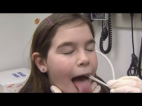 What are the signs and symptoms of strep throat?