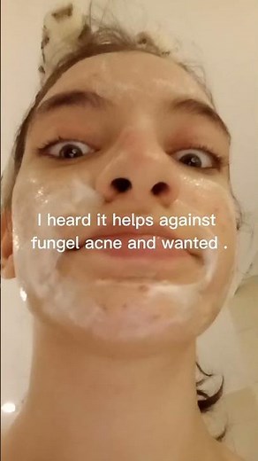 Head and shoulders face wash?? #hack #acne #acnetreatment #face #facewash #skincare #skin #redness