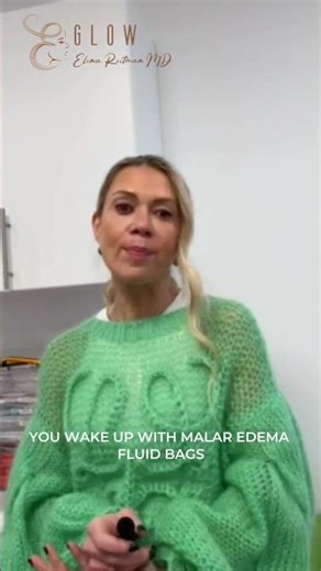 Your Under-Eye Filler Might Be Causing Those Puffy Eyes