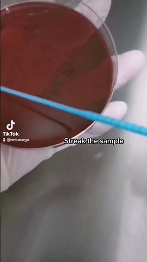 Stool culture this fecal sample #laboratory #stool #microbiology #bacteriology #differentialagar #mt