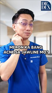 1.1M views · 19K reactions | Acne sa Jawline? #JawlineAcne #HormonalAcne #AdultAcneSolutions #AcneCommunity #SkincareEducation #AcneManagement #HormoneImbalance #HealthAndWellness #ClearSkinJourney #DermatologyTips | Dr. Dex Macalintal | Facebook