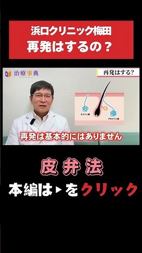 【皮弁法】再発の可能性は？｜ワキガ治療の手術法 #ワキガ #体臭 #皮弁法