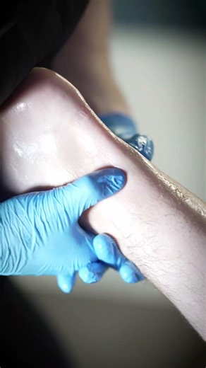 This is whats causing your ACHILLES PAIN! #shorts