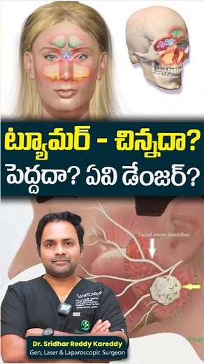 Lipoma Removal | Lumps in Body | Lump in Neck | #ytshorts #healthtips #lipomatreatment #lumps