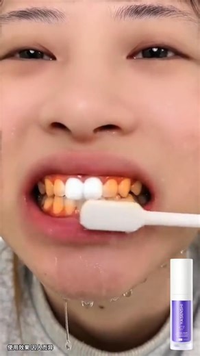 💜 Brighten Your Smile Instantly with V34 Colour Corrector! 😁 Tired of yellow tones and dull teeth? V34 uses color-correcting technology to neutralize stains and reveal a whiter, more radiant smile—no peroxide, no pain! ✅ Safe for daily use ✅ No sensitivity ✅ Instant whitening effect Smile brighter today! ✨🦷 | Lan Phương