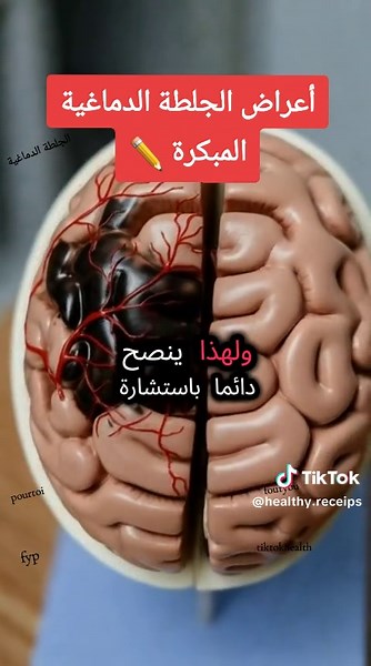 أعراض الجلطة الدماغية المبكرة #أعراض_الجلطة_الدماغية_المبكرة #علاج_طبيعي #أعراض #fouryourpage #pourtoi