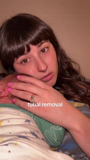 Understanding Tubal Removal and Birth Control Choices