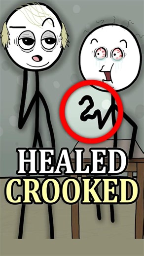 Broken Bones Could Leave You Deformed 🦴😮 #history #facts #medieval #shorts