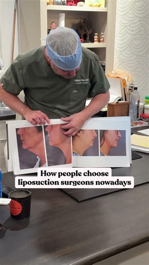 How do people choose a liposuction surgeon nowadays?