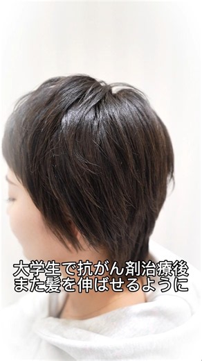 大学生で抗がん剤治療後。また髪を伸ばしていけるように #抗がん剤後の髪 #脱ウィッグ #縮毛矯正 #AYA世代 #アピアランスケア