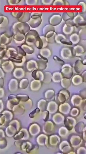 Red blood cells under the microscope