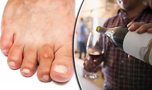 Gout diet: High fibre diet could cure painful form of arthritis