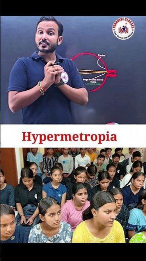 “Hypermetropia Explained 👓 | Far-Sightedness Made Easy”