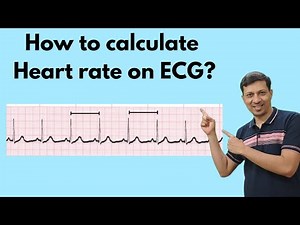 How to Calculate Heart Rate on ECG in Seconds | ECG Basics for Medical Students