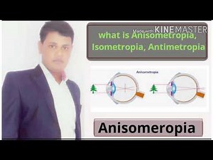 Anisometropia | Isometropia | Antimetropia | Simple | Compound | Mixed anisometropia | treatment