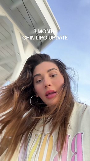 Chin Liposuction Recovery Journey: 3 Month Update