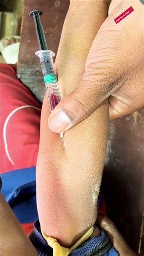 🇮🇳 Ceftriaxone 250mg iv injection !💉🩺🏥 #shorts #viral #trending #injection