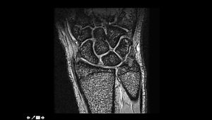 Interpretation of Wrist MRI - Detailed Anatomy